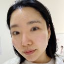 옐로우 팩토리 | 구래동 피부관리 esv10 이뮨팩토리 온빛 모공케어 후기