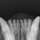 해든덴탈 이미지