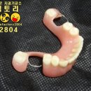 스마일기공소 이미지