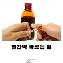 빨간 소독약 바르는법? 이미지