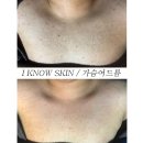 아이노스킨