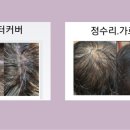 헤어존 신비