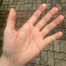 유상호한의원 | [손목] 고대안산병원 우측 손목, 엄지 수술 3-4개월 차(+재활, 외래)