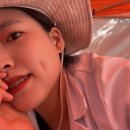 홍대비앤미의원 | 비앤미 보조개 재수술 찐 후기 (내돈내산) 시술 전, 당일 + 10일의 기록