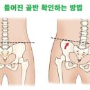골반교정 필라테스 이미지