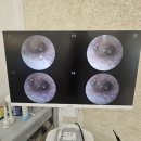 소리보청기 이미지