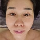 한나전기조명 | 선릉피부관리 뷰티한나 피부관리 후기