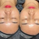 드림메드 | [뷰티] 부산 명지동 피부관리 올가드림뷰티 명지점에서 모공디톡스 받고 왔어요
