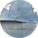 중앙내과의원 | 켈로이드 피부 귓볼켈로이드 수술 후기 피어싱켈로이드