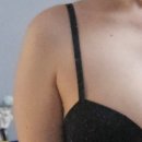 초이스외과의원 | 웨촬하고 현타와서 팔 지방흡입 상담다닌 후기(ㄷㄹㅇㅌ,ㅃㄴㄱㅃ,ㄹㅂㅊ)