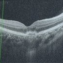 우안과의원 이미지