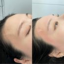 아나덴슈가링왁싱 부천옥길점 | 아나덴 슈가링 왁싱 부천옥길점 찐 후기