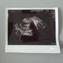 부여동물약국 | [P4:임신 초기] 2개월(5주차) 일상 : 아기집 초음파, 유성구보건소임신축하선물, 국민행복카드 발급...