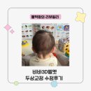 수정 | [공지] 비바헬멧 두상교정 두상헬멧 6개월 아기 단두교정 수정후기