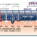 전기 수술기 (Bovie) 이미지