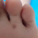보라매동주민센터 | 서울특별시 관악구 보라매동 대상포진 전문병원 추천 | 무료접종 | 예방접종