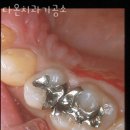 다온치과기공소 이미지