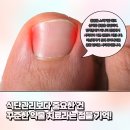 좋은영도내과의원 네이버블로그