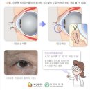 새봄안과