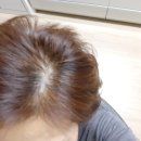 헤어클레시스