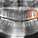 보스턴완치과의원 이미지