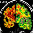 오토핏보청기 광진센터 이미지