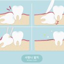 첫사랑니치과의원 이미지
