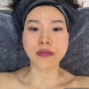 장유늘푸른약국 | [김해] 율하 맞춤 에스테틱 '미채움' 또간집후기