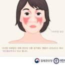 자가면역질환의 종류와 원인 증상 검사 방법은? 이미지