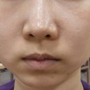 올림피움채움올피채의원 이미지