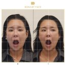 7554 | 광대축소 효과 제대로 뵨 보나트페이스 두상축소 관리 후기