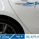 덴트존 이미지