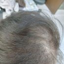 좌동산책길 | 부산가발 잘하는 곳, 해운대 좌동에 있는 나나가발미용실 다녀온 솔직후기