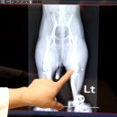 스마트 정형외과 신경외과 동물병원 네이버블로그