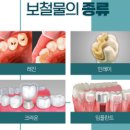 디자인탑치과기공소 네이버블로그