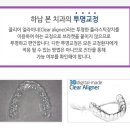 하남우리치과 네이버블로그