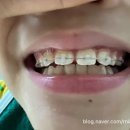 슈어치과교정과치과병원 네이버블로그