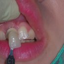 거성치과기공소 이미지