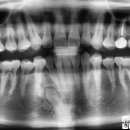 찬스플란트치과의원 이미지