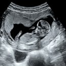 이삭토스트 송우주공점 | [임신10주차 - 임신12주차]