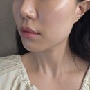 유일카클리닉부분정비 | 합리적인 가격 Ai피부과 티타늄리프팅 30kj 후기