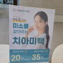 창원 치과추천 가음정윤치과의원 치아미백 오픈 기념 미백 받아보기편