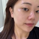 플라플로 | 대구 수성구 피부관리 '팔월 에스테틱' 환한 피부 만들기 미백 플라소노자임 후기