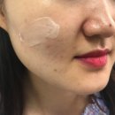 스킨룩스에스테틱 | 더마허브 청대연고 후기 남겨봅니다