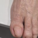 에러퍼펙트