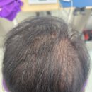 매트로펠리스Ⅱ-B | 부천 두피관리 큐사랑 부천지사 방문 후기