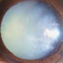 연세진안과 이미지