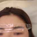 UR(오산시)-[수목원로]-하-7 | [오산] 이제는 못난 눈썹 잔흔제거도 '메이드미'