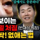 "돈 쓰지 말고 '이것' 하세요" 10년은 늙어 보이게 만드는 눈 밑 처짐, 팔자주름 싹 사라집니다! (반재상 원장 1부) 이미지