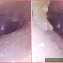 포낙보청기 남포센터 이미지